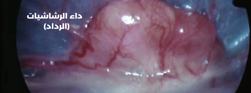 Aspergillosis (Al-Riddad) - Al Arabi Falcons