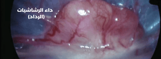 Aspergillosis (Al-Riddad) - Al Arabi Falcons
